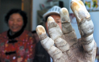 奇怪的“人手”形灵芝 ()