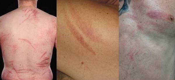 u=422189360,3549532965&fm=170&s=5F0893452E635D3C5E2AFDE703002029&w=600&h=276&img