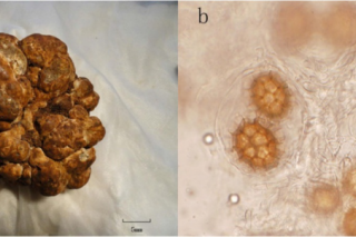 中国商业黑松露和白松露侵染欧洲榛、麻栎取得新进展 ()