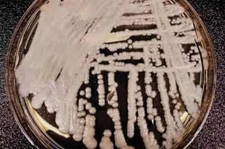 “超级真菌”大爆发？专家：健康人群不会感染 无需恐慌 ()