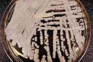 关于“超级真菌”的N个真相 ()