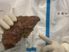 旅客携带4株未加工干灵芝入境被查，青岛海关：存在极大的动植物疫病疫情风险 ()